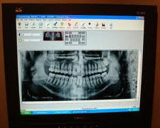 Adult and Pediatric Dentistry - Dental Radiographs